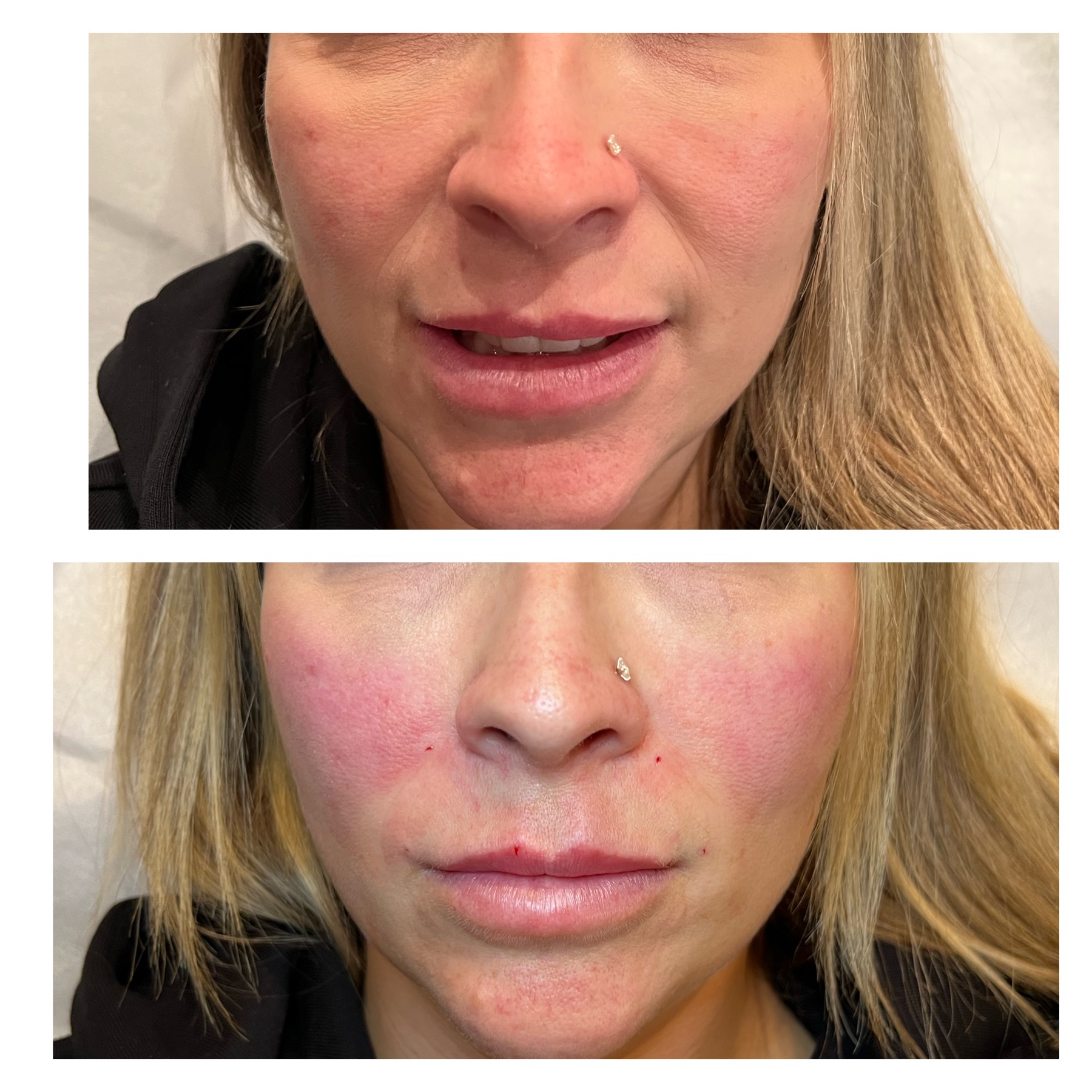 Signature Sqin facial treatment