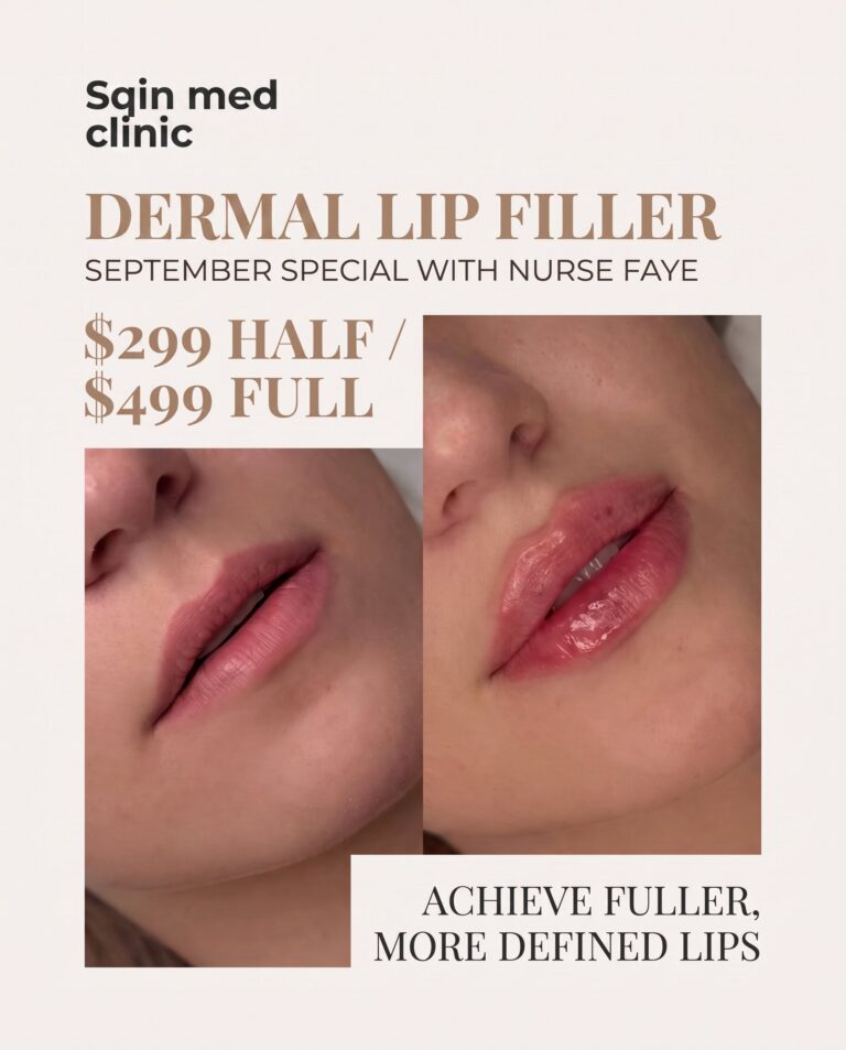 september clinic lip filler discounted price